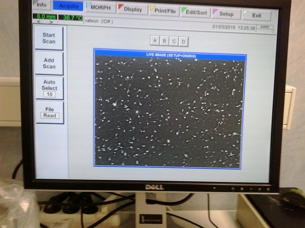 les paillettes.. de Watson...magie de la science..